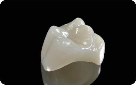 All-Ceramic Crown