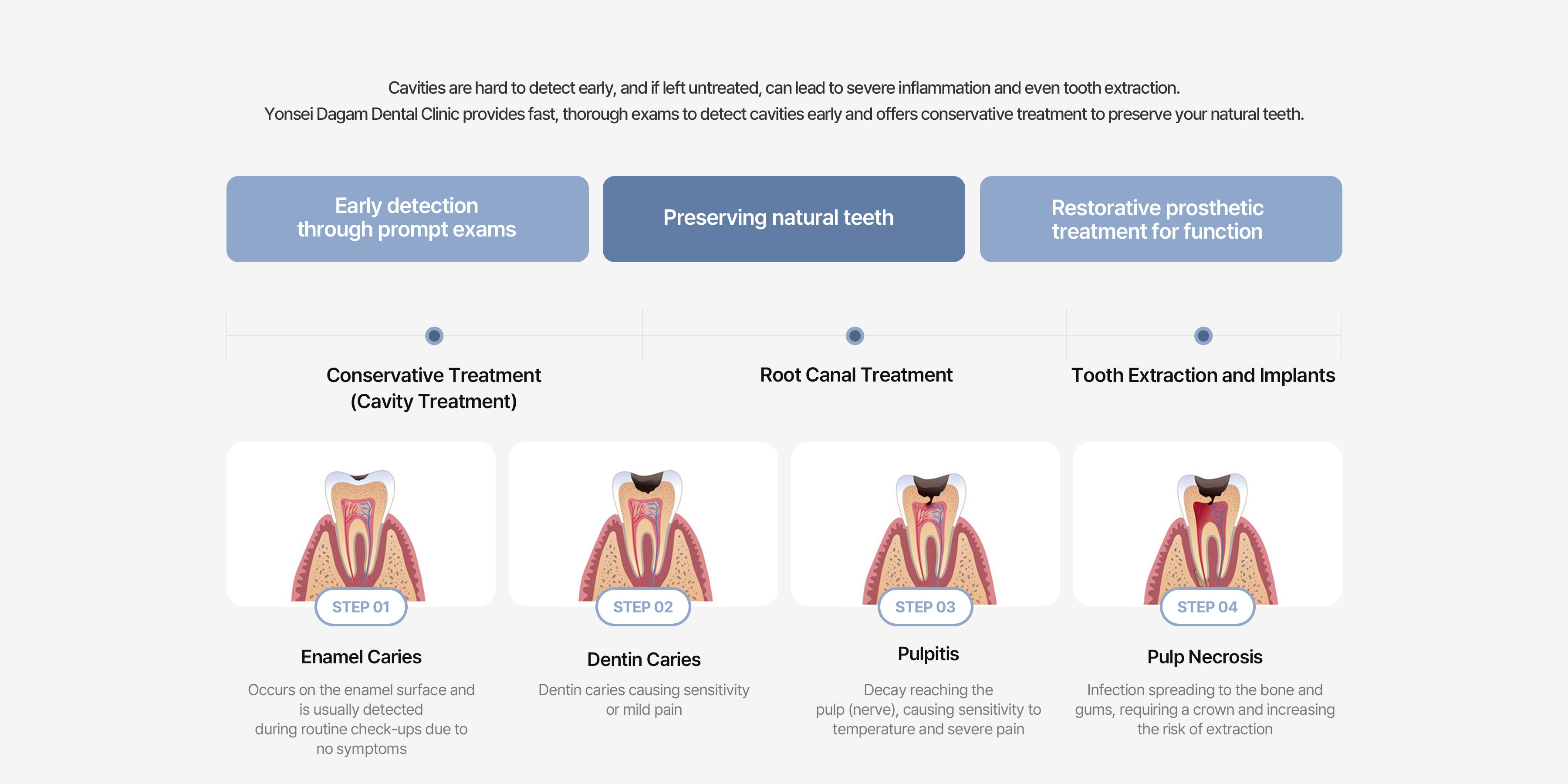 Natural Tooth Preservation 2
