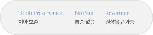 무삭제 라미네이트