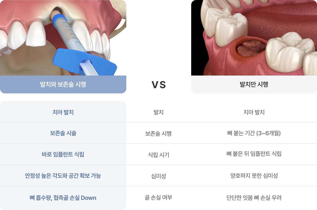 발치와 보존술
