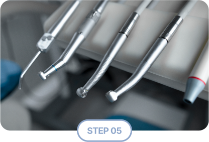 STEP 05